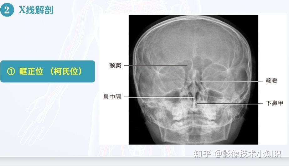 头颅X线摄影及其解剖 - 知乎