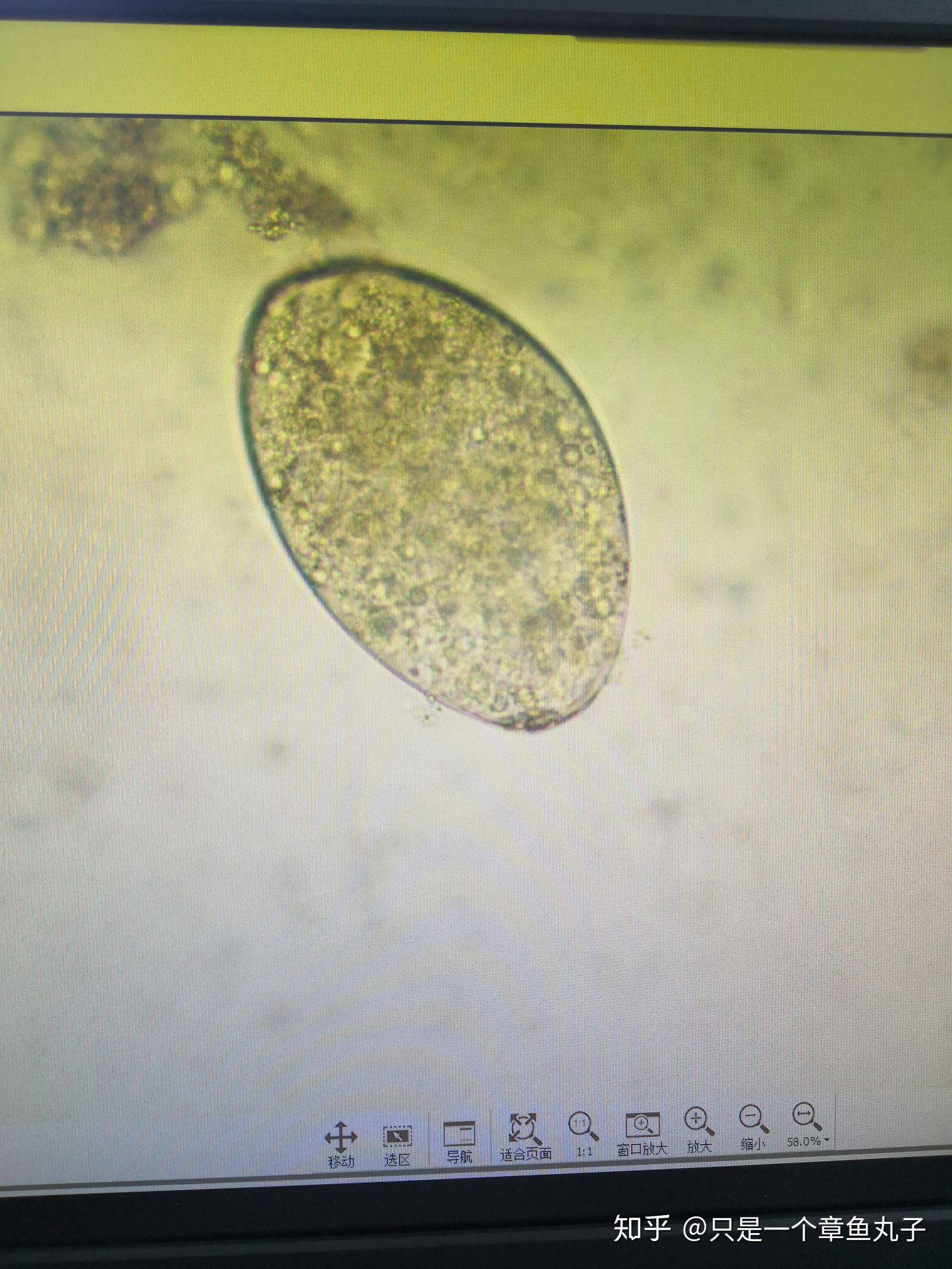 肺吸虫显微镜图片