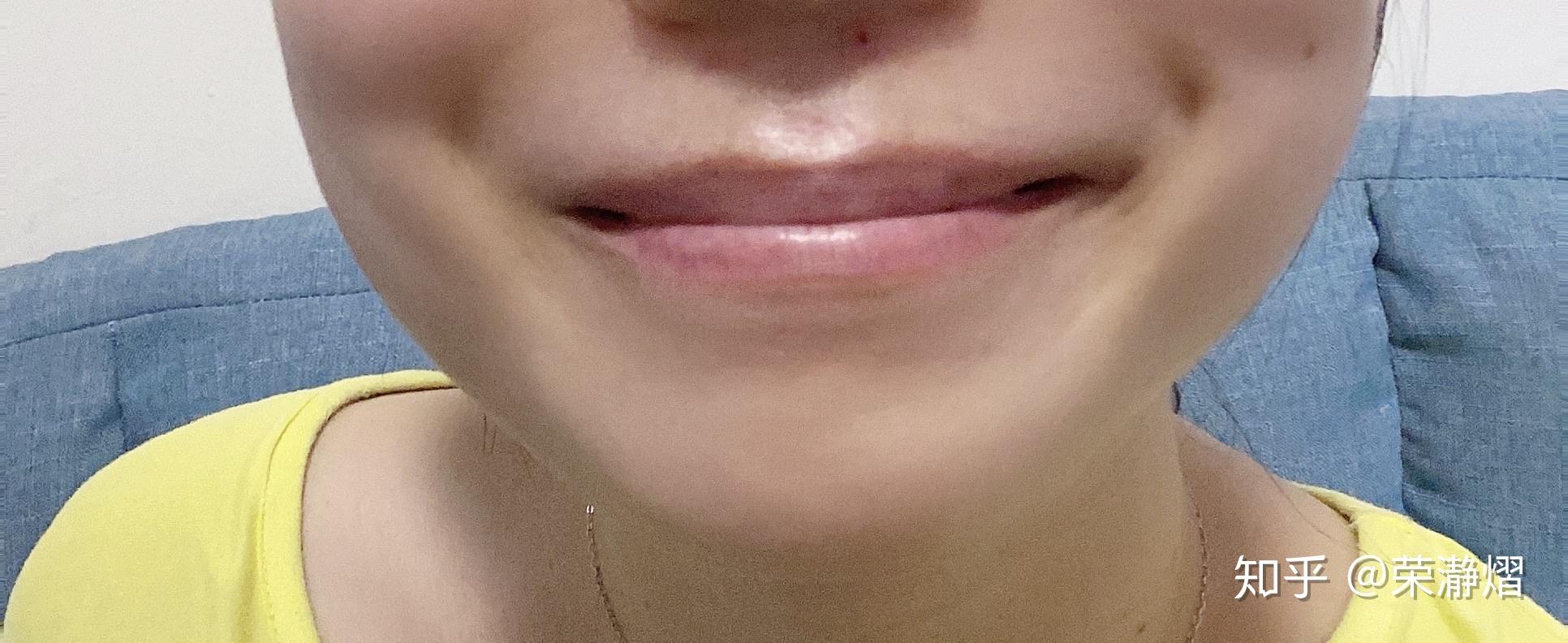 嘴角上面的窝是什么啊酒窝梨涡皱纹