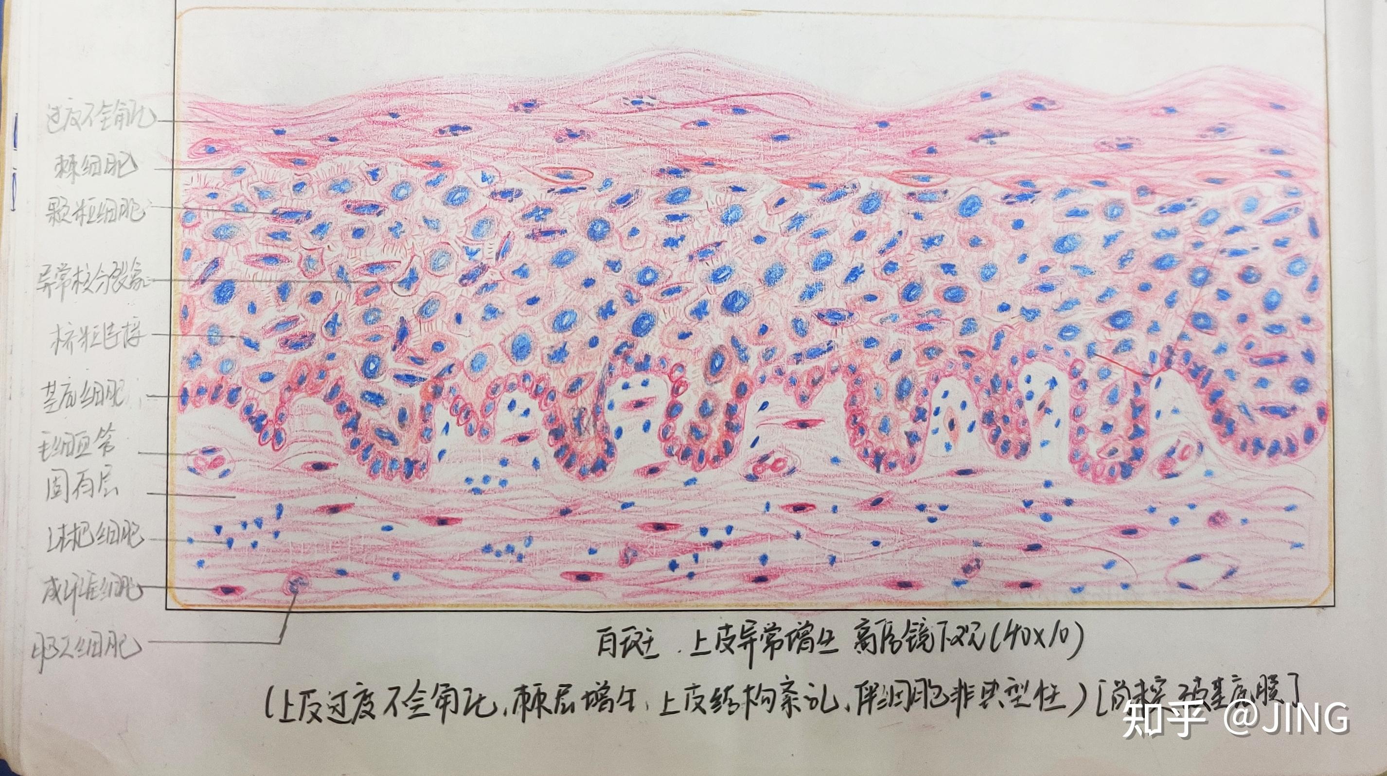 一些口腔组织病理学的红蓝铅笔图