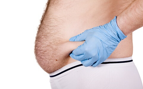 男士的小肚腩减肥有什么好方法?