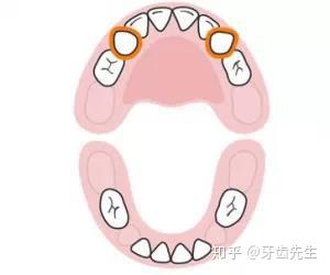 v2-9e4ee4175ce9c16b02fc0de86631d7b2_b.jpg