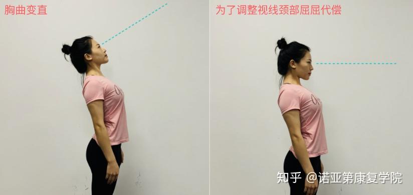 直背的富贵包该如何调整第3期