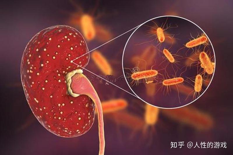 新型冠狀病毒304消毒效果檢查間接溶血性鏈球菌猩紅熱