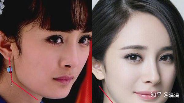 陈小纭,也是一个换头很成功的女明星,没削骨之前下颌骨很宽大,现在