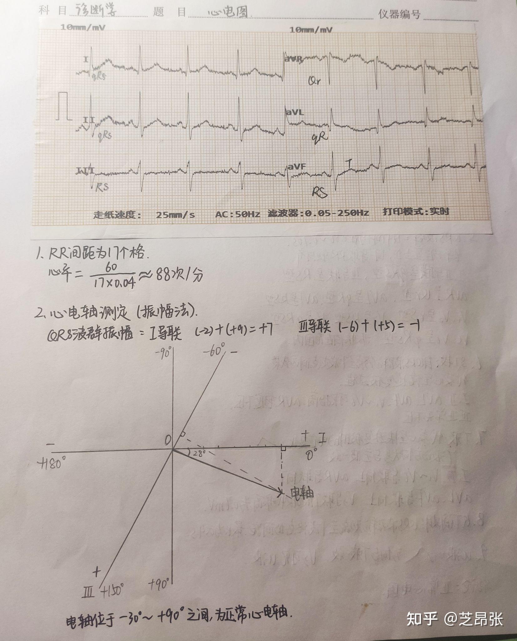 心电图报告书写顺序图片