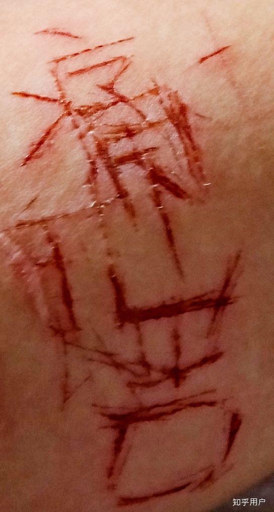 非主流时期在自己手臂上划的疤该怎么跟别人解释