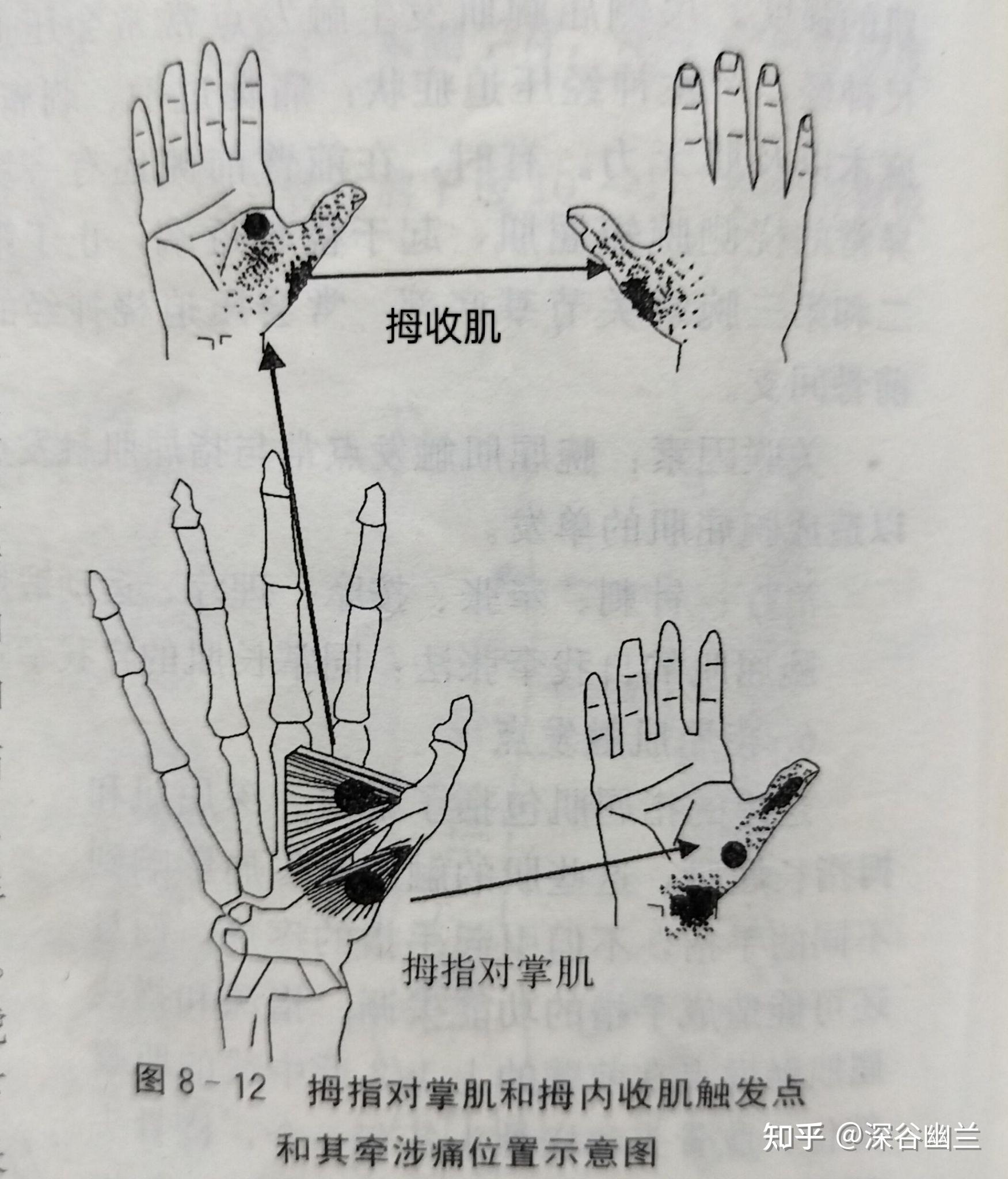 第一掌骨的背侧和外侧,并向整个大鱼际区,拇指外侧和背侧,虎口弥散