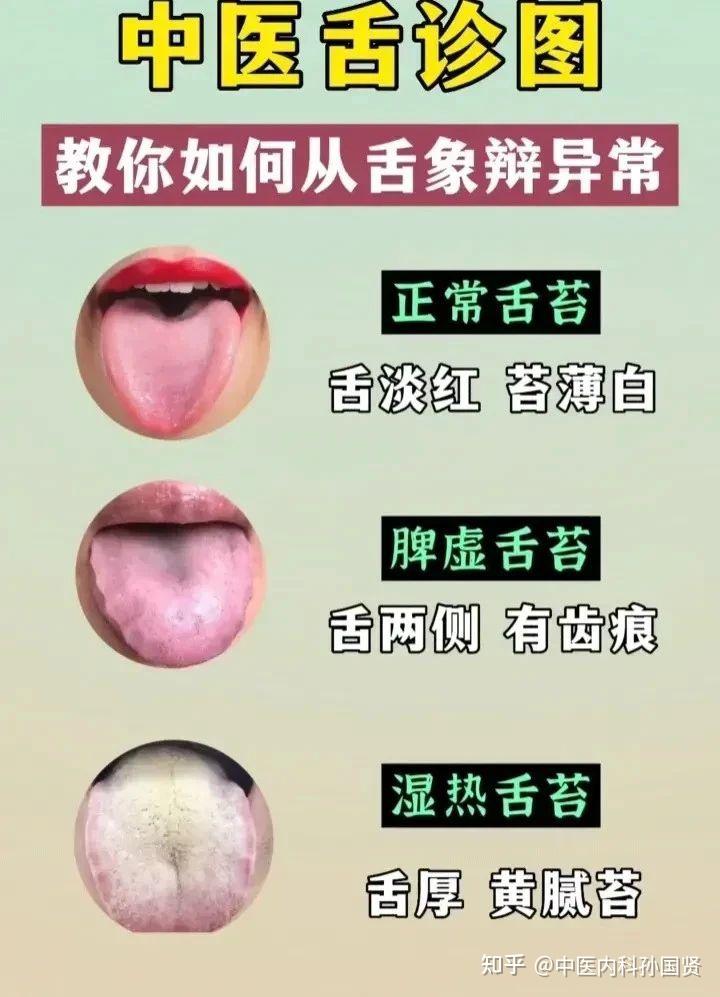 三焦不通一身堵!上焦火、中焦湿、下焦虚,3 个中成药打通三焦,浑身轻松 - 知乎
