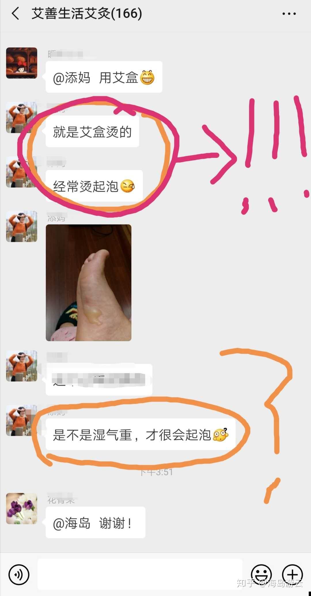 还有一个梗,艾灸后出水泡是排湿还是烫伤?