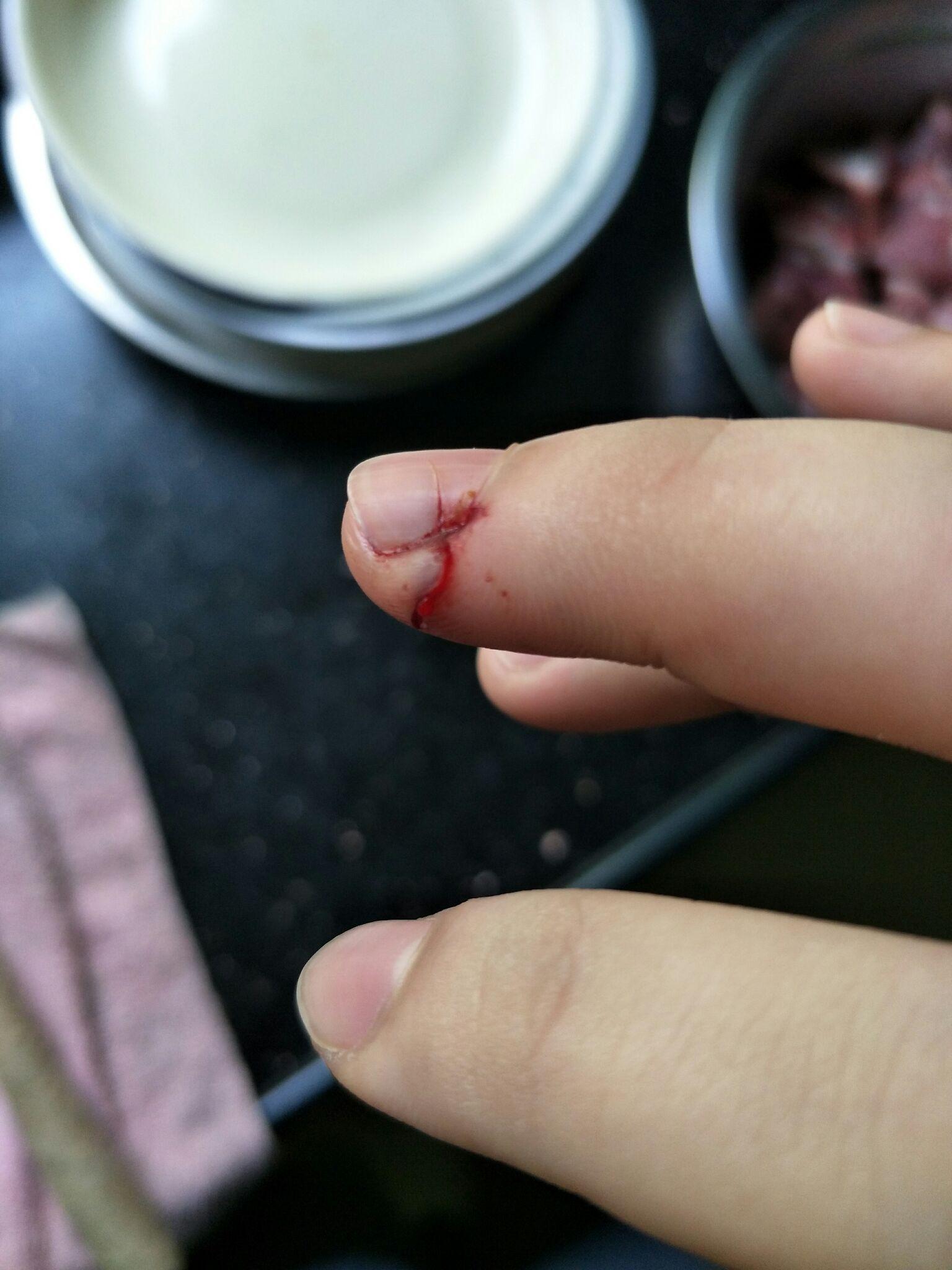 切菜时切到手是一种什么样的体验