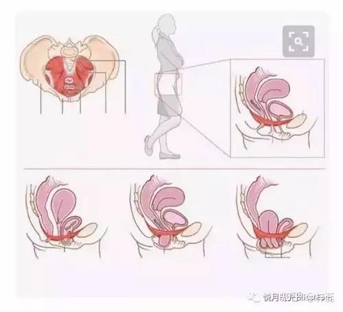 子宫下垂动作图片