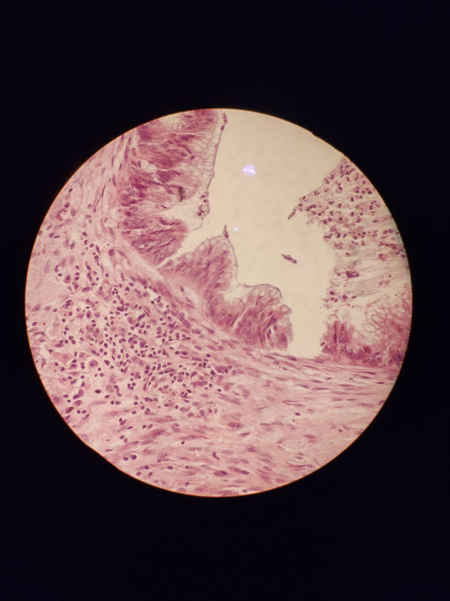 奥林巴斯bh2显微镜观察头清霉记