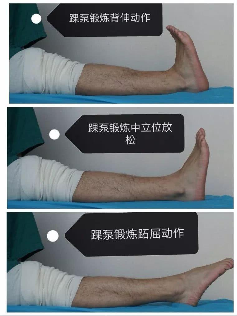 膝关节前交叉韧带损伤术后如何康复