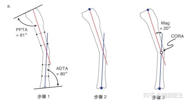 瑞麟醫生帶您讀矯形外科原則五矢狀面畸形