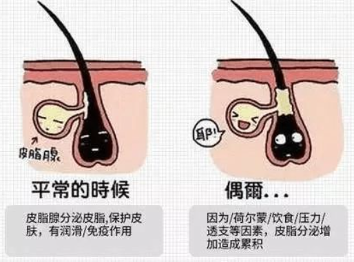 伊贝诗肤肤品怎么样_保肤伞孕妇能用吗_孕妇保养护肤品