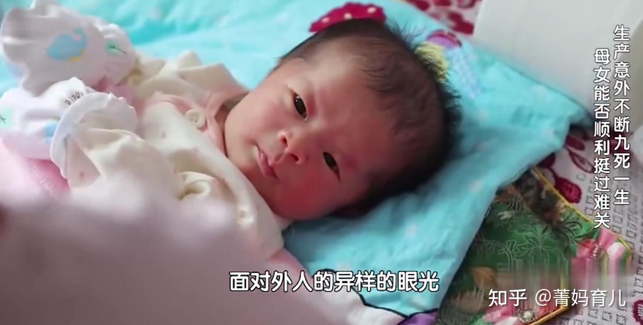 独立自主的瓷娃娃侯丽丽是一个瓷娃娃,一直到她18岁的时候骨折才少