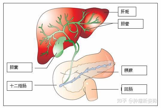 胆管癌早期症状图片