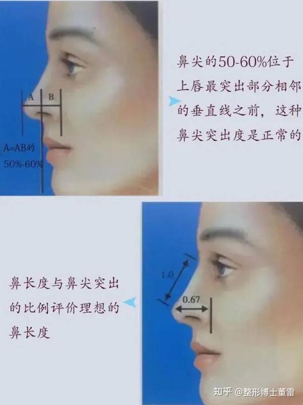 四大常见的鼻尖整形方法都有哪些? - 知乎
