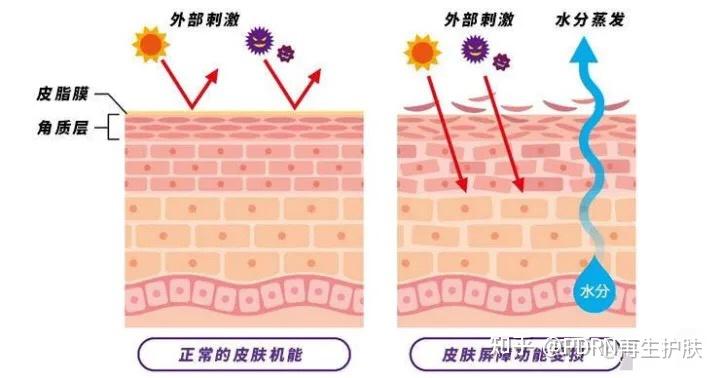 分清过敏和敏感,教你如何一招识别敏感肌! - 知乎