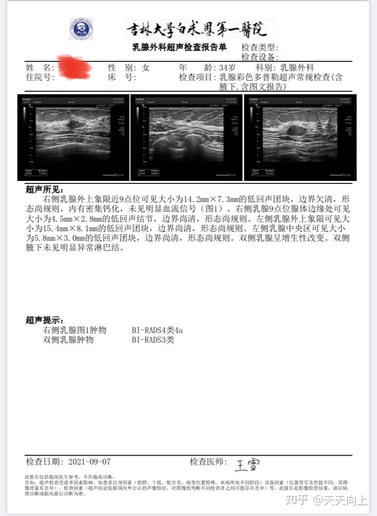 乳腺鉬靶4a歷劫之路