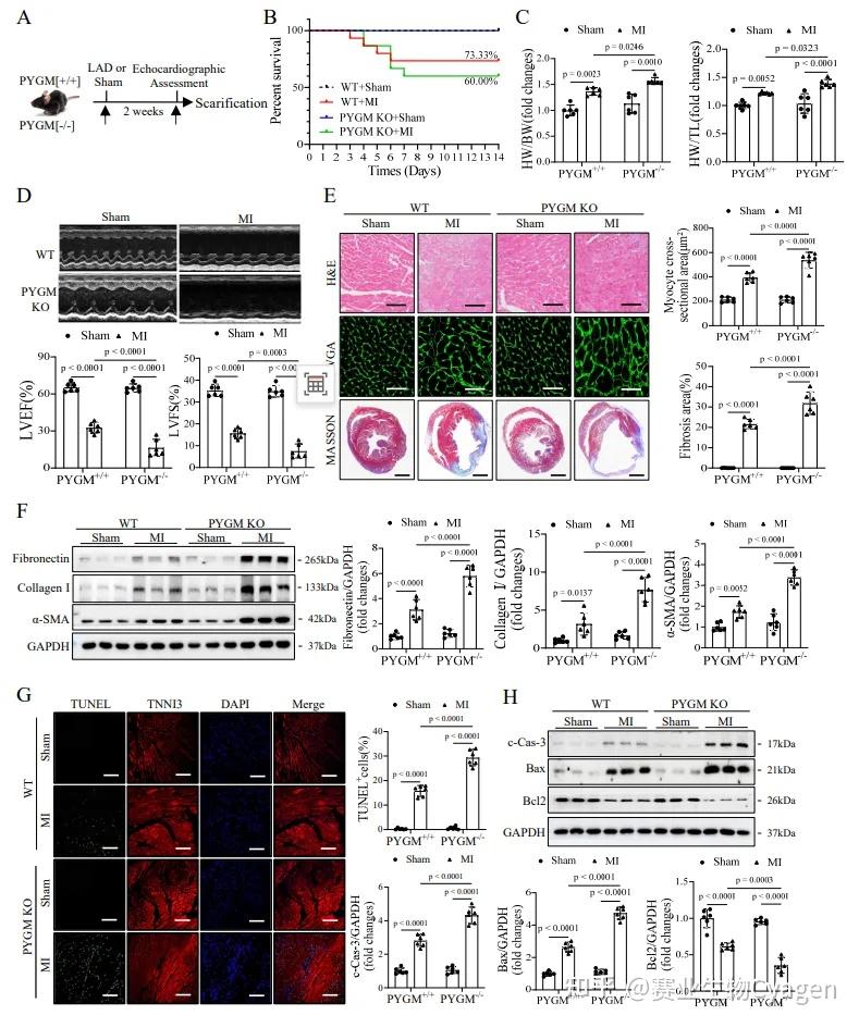 Circulation（IF=38.6）丨PYGM通过促进糖原分解与自噬流保护心肌梗死 - 知乎