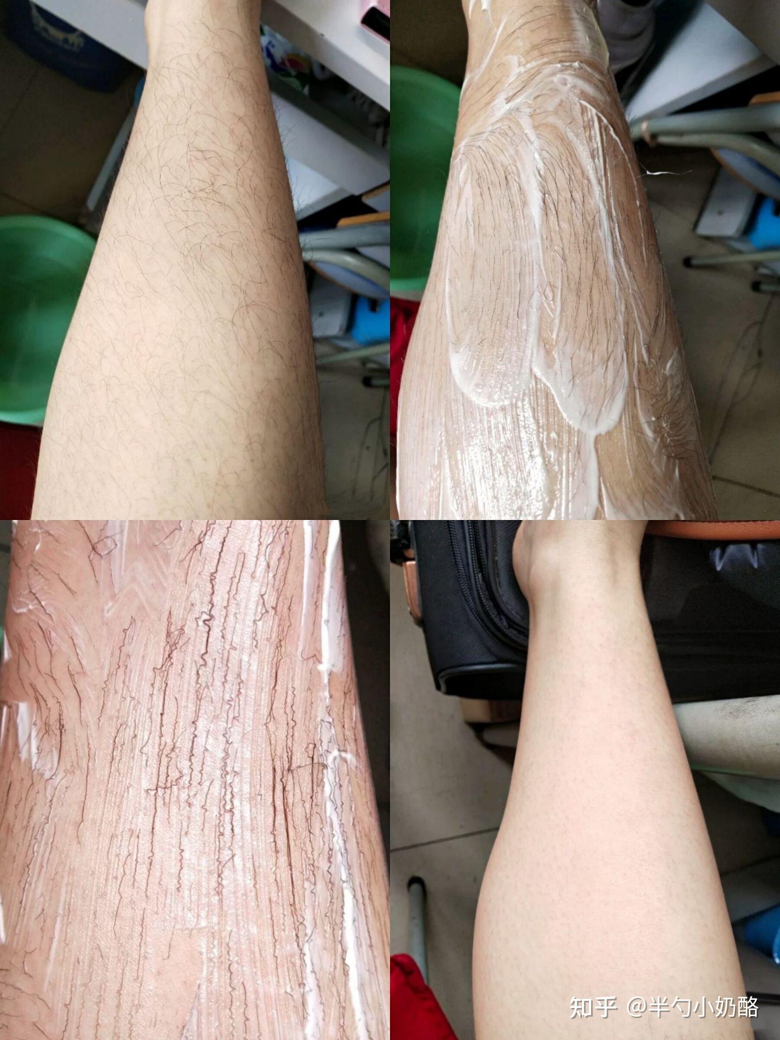 有没有脱毛后没有黑点点的脱毛膏推荐?