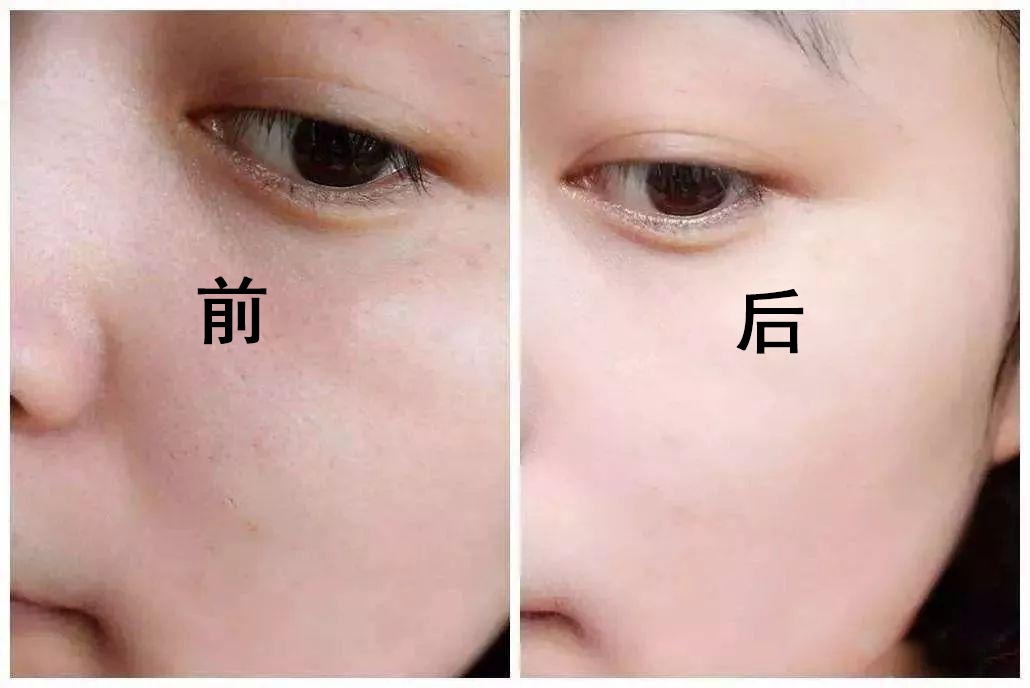 v2-a0a4bd1845abe7a1e2025e65c672d504_1440w.jpg?source=172ae18b