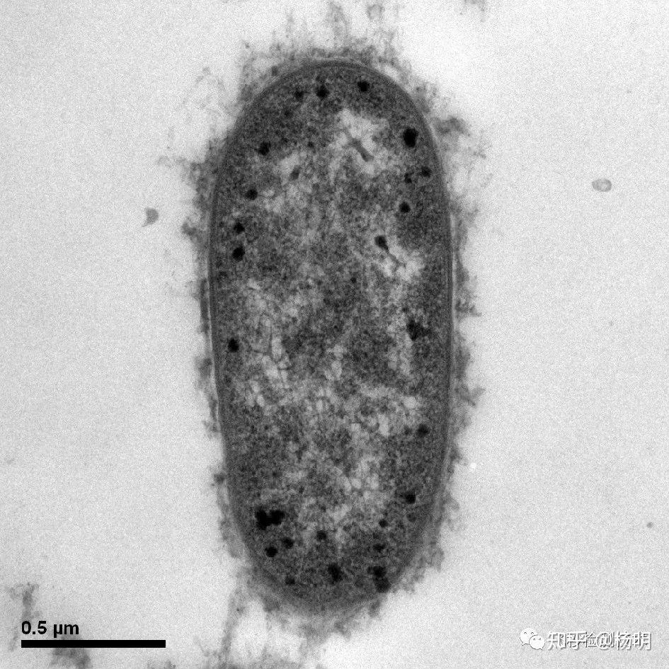大肠杆菌电子显微镜图片
