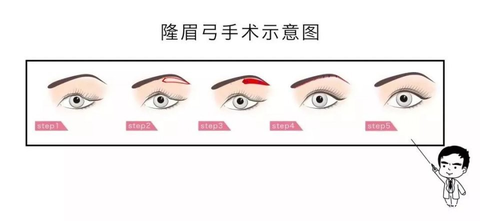 眉弓 知乎