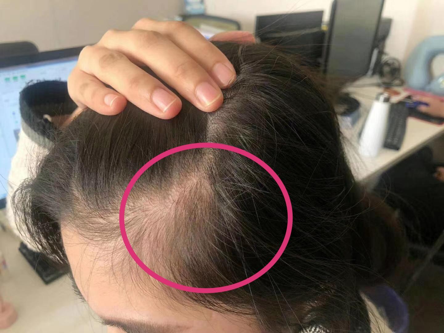 v2-a0be17675d600c572b3f106e1cdafb6f_1440w.jpg?source=172ae18b