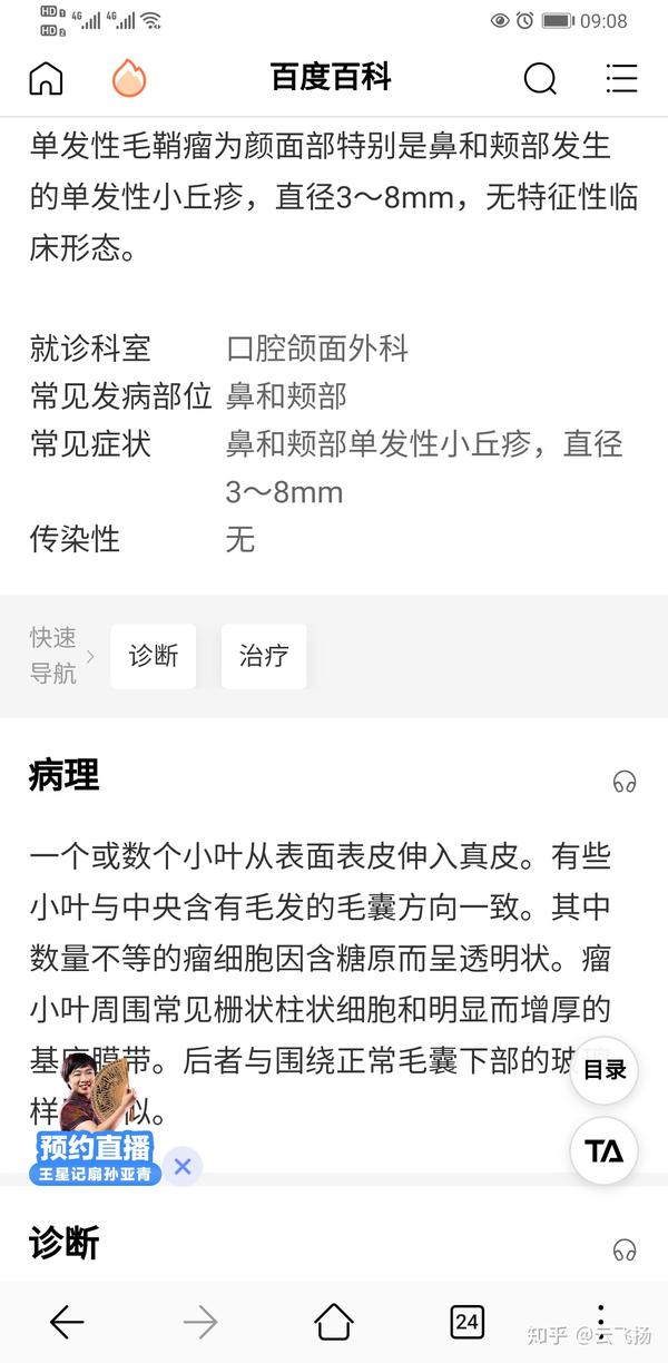 什么是单发性外毛根鞘瘤 什么是单发性外毛根鞘瘤 柏然网