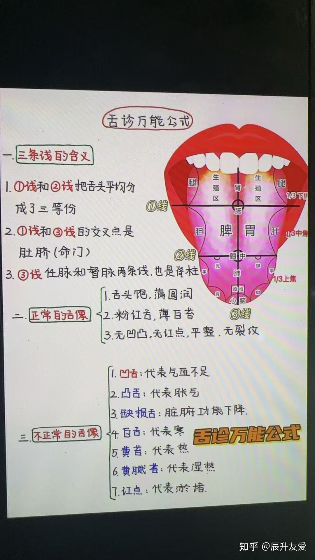 观舌知健康,舌诊详解 - 知乎
