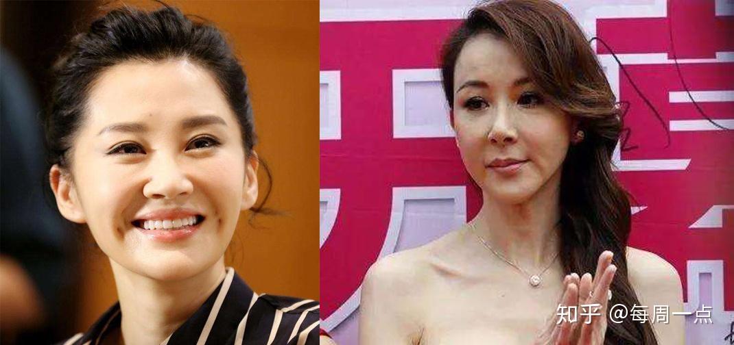 从《瑞丽》模特到头部网红,张大奕的成功离不开整容的功劳.