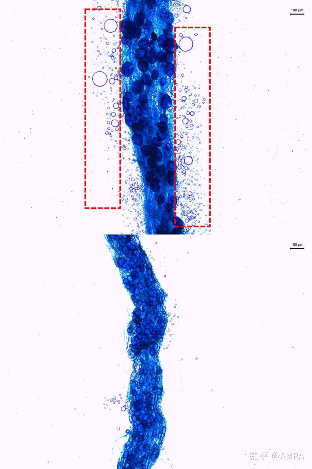 科学网—大豆单细胞水平根瘤发育和共生固氮转录图谱 - 孙宝成的博文