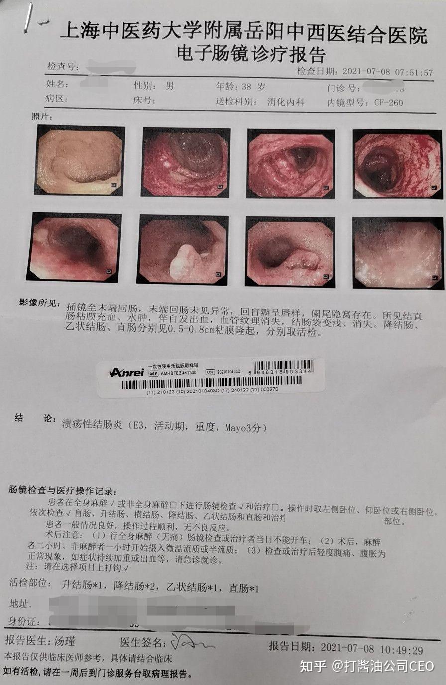 肠镜活检报告图片