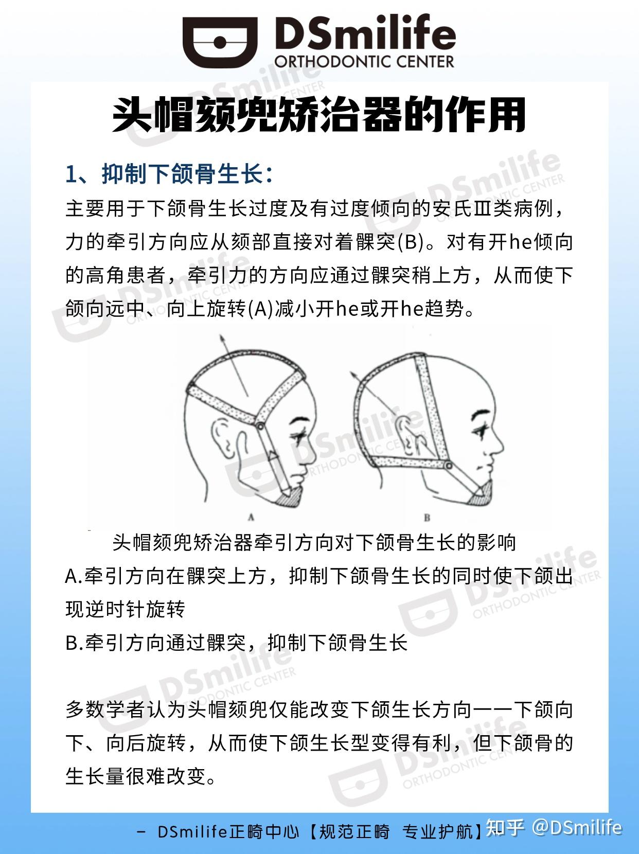 矫正牙齿带头帽图解图片