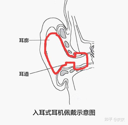 半入耳和入耳式图解图片