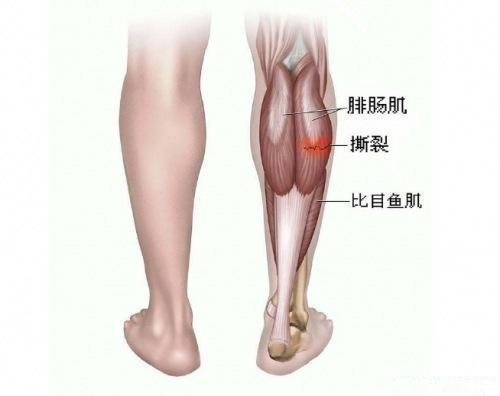 v2-a111f37526843296f839e714c27d38f6_1440w.jpg?source=172ae18b