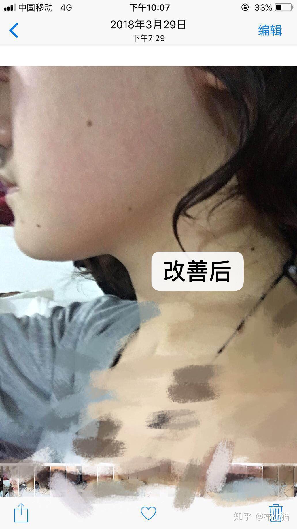 脸骨大怎样最完美瘦脸?