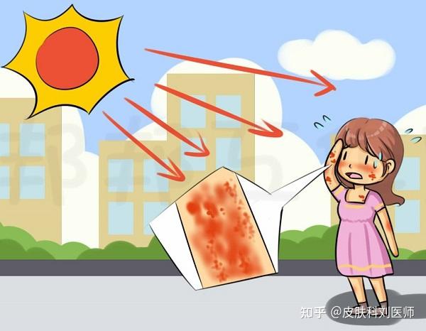 【郑州肤康皮肤病医院】皮肤晒伤的"三个阶段",看你属于第几种?