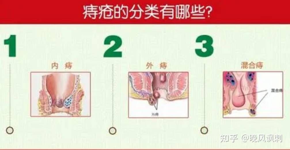 眼睛瘙痒与疼痛：常见原因及应对措施