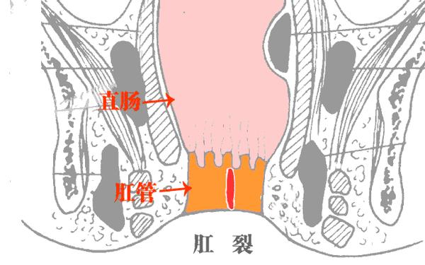 肛管位置图图片