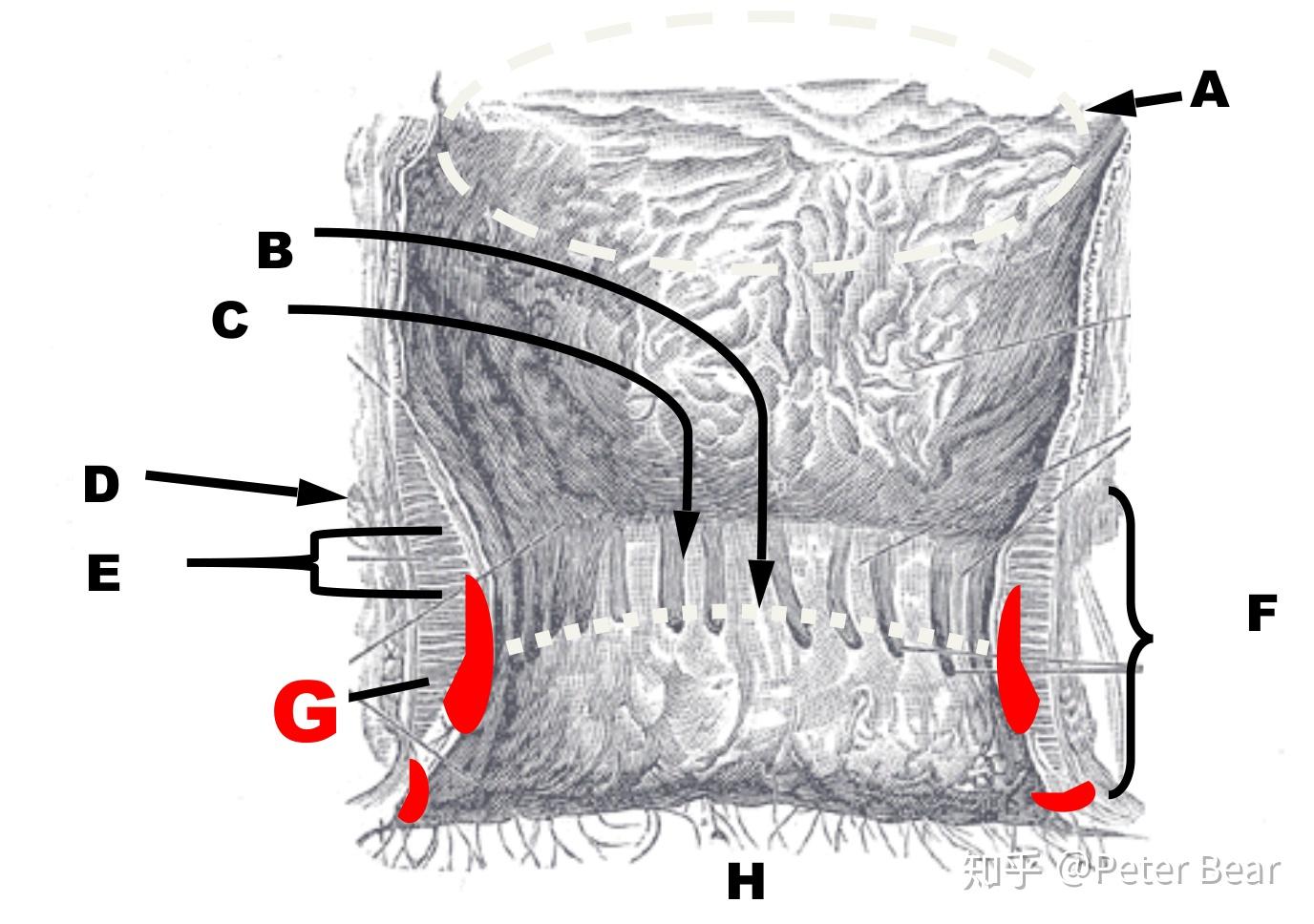 药剂师学习笔记之痔疮(Hemorrhoids) - 知乎