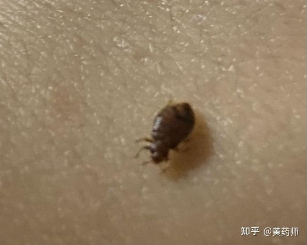 床虱臭虫怎么灭？ - 知乎