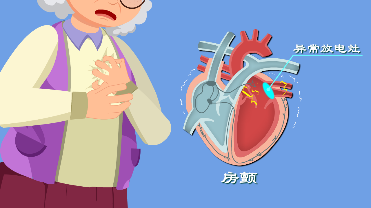 心律失常咋回事心慌胸悶背後真相是啥房顫發病機制動漫版