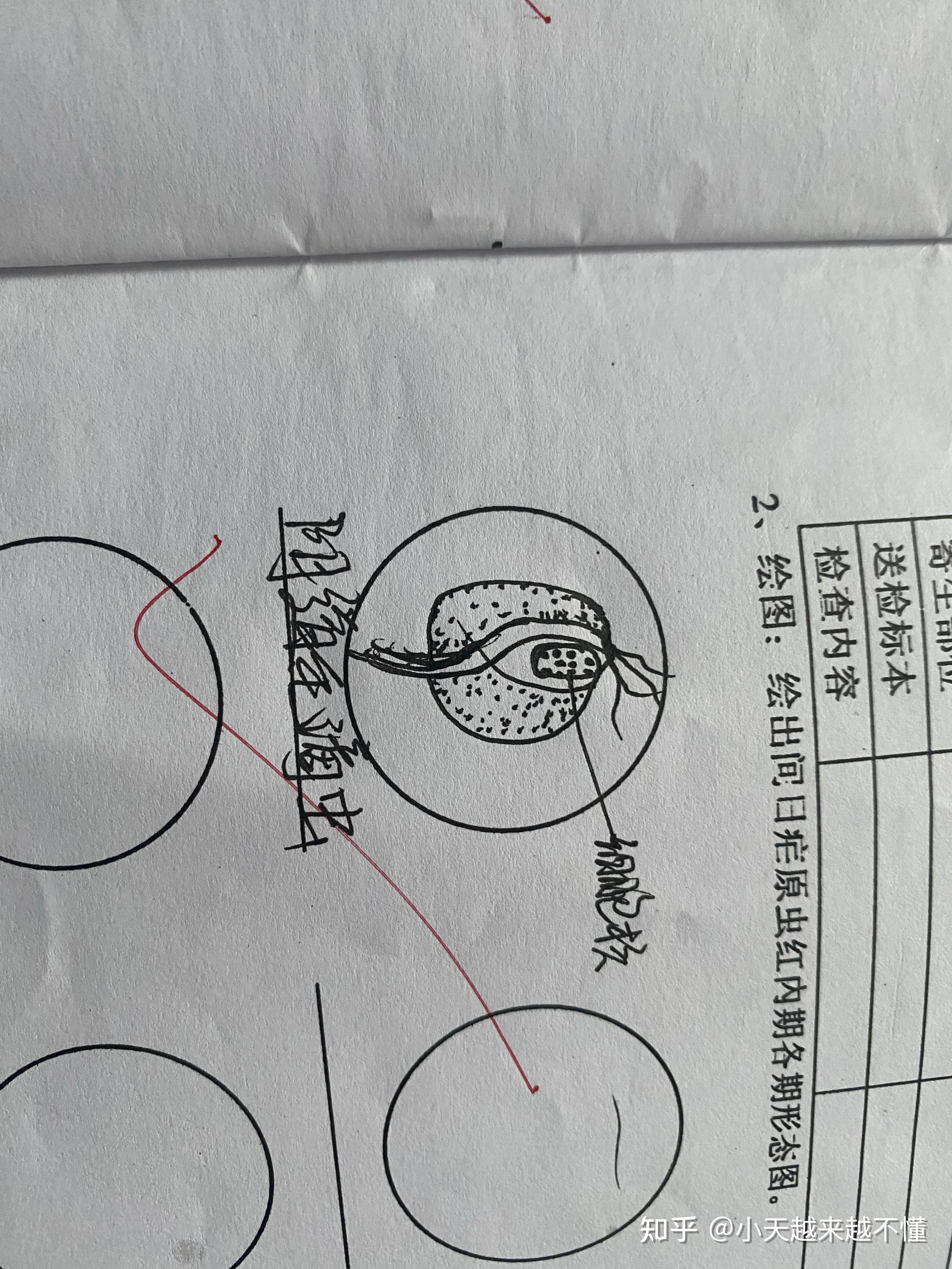 大學病原生物實驗課人體寄生蟲顯微鏡下蟲卵形態實驗報告已出爐