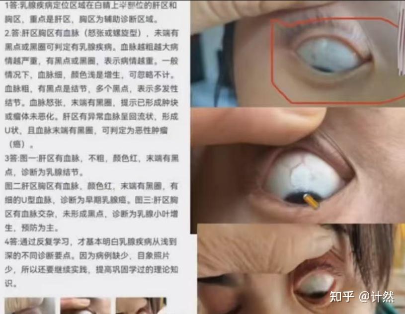 瑶医目诊 - 知乎