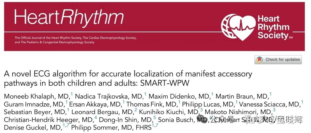 《Heart Rhythm》预激综合征快速精准定位流程：“SMART-WPW”流程 - 知乎
