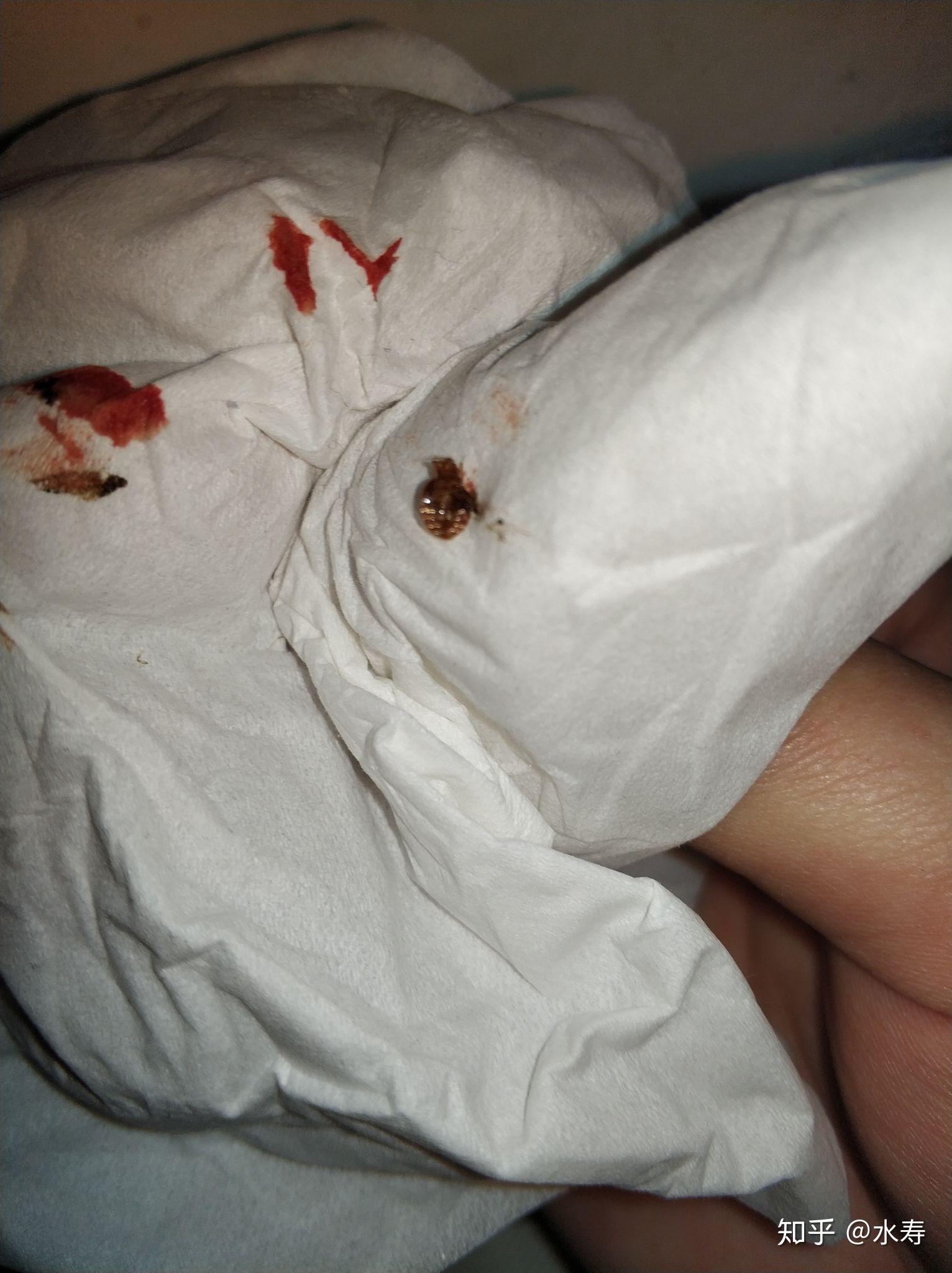 床头吸血虫图片图片